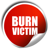 New Jersey Burn Injury Lawyers weigh in on Burn Awareness Week and discuss prevention. 