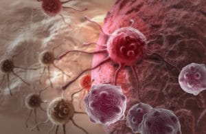 Cancer Detection and the Consequences of Misdiagnosis
